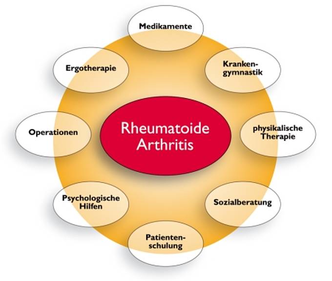Rheumatoide Arthritis / chronische Polyarthritis